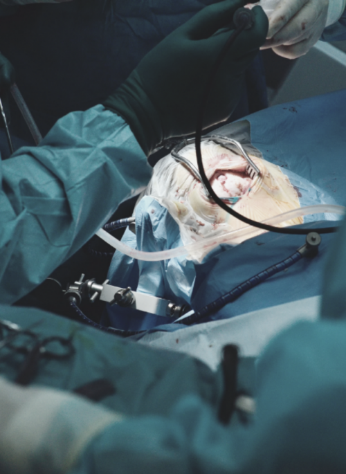 neurochirurgia kosice